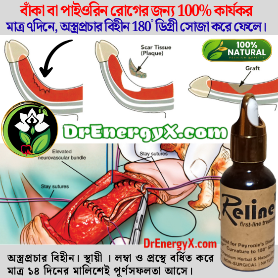 DrEnergy_Reline180° লিঙ্গ বক্রতাকে সোজা করার জেল (অতিরিক্ত কাজ + ১.৫"+বৃদ্ধি এভারেজ)। এটি পেইরোনি'স রোগের বিশেষজ্ঞ। ৩০° / ৬০° বক্রতাকে ১৮০° সোজা করে।